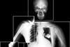 Xray