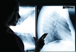 lungs_xray.jpg